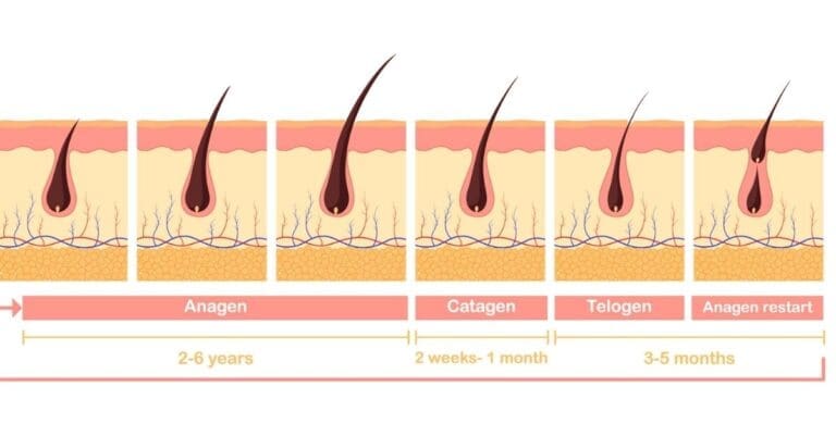 image with the 5 stages of hair growth